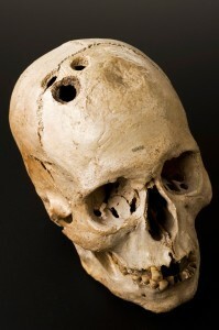 Bronze age skull