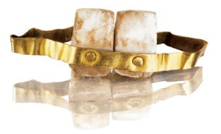 Etruscan lower teeth denture (c.700 BCE)