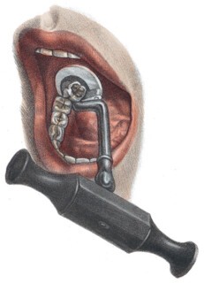 Extraction technique from Jean-Baptiste Bourgery’s ‘Traité complet de l’anatomie de l’homme’